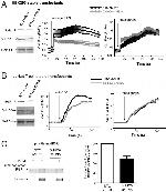 IP3 Receptor 1 Antibody in Immunoprecipitation (IP)