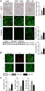 Cannabinoid Receptor 1 Antibody in Immunohistochemistry (IHC)