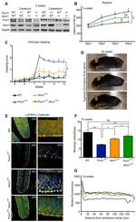 IP3 Receptor 1 Antibody in Immunocytochemistry (ICC/IF)