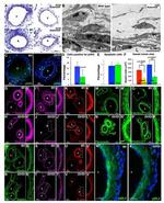 Versican V0, V1 Neo Antibody in Immunohistochemistry (IHC)