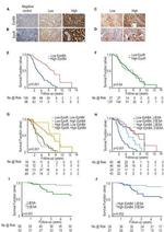 EphB4 Antibody in Immunohistochemistry (IHC)