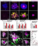 Amyloid Precursor Protein Antibody in Immunohistochemistry (IHC)