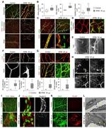 Claudin 5 Antibody in Immunohistochemistry (IHC)