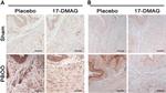 HIF1A Antibody in Immunohistochemistry (IHC)