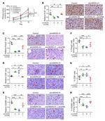 CD8a Antibody in Immunohistochemistry (IHC)