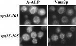 VMA2 Antibody in Immunocytochemistry (ICC/IF)