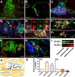 HuC/HuD Antibody in Immunocytochemistry, Immunohistochemistry (ICC/IF, IHC)