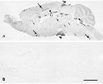 beta Amyloid (1-42) Antibody in Immunohistochemistry (IHC)