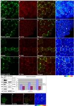 Phospho-FAK (Tyr861) Antibody in Western Blot, Immunocytochemistry (WB, ICC/IF)