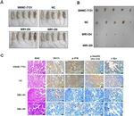 MUC1 Antibody in Immunohistochemistry (IHC)