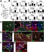 LYVE1 Antibody in Immunohistochemistry (IHC)