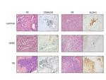 CD44 Antibody in Immunohistochemistry (Paraffin) (IHC (P))