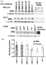 Estrogen Receptor beta Antibody in Western Blot (WB)