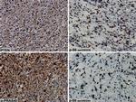 Phospho-PRAS40 (Thr246) Antibody in Immunohistochemistry (IHC)