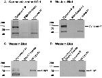 Dynamin 1 Antibody in Western Blot, Immunoprecipitation (WB, IP)