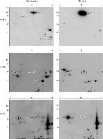 Phosphothreonine Antibody in Western Blot (WB)