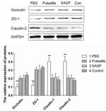 Claudin 2 Antibody in Western Blot (WB)