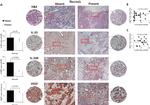 ST2 Antibody in Immunohistochemistry (Paraffin) (IHC (P))