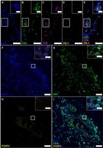 FOXP3 Antibody in Immunohistochemistry (IHC)