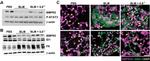 BMPR2 Antibody in Immunocytochemistry, Immunohistochemistry (ICC/IF, IHC)