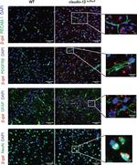 CD140b (PDGFRB) Antibody in Immunocytochemistry, Immunohistochemistry (ICC/IF, IHC)