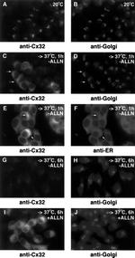 Connexin 32 Antibody in Immunocytochemistry (ICC/IF)