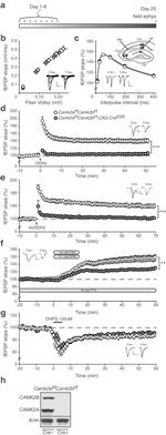 CaMKII beta Antibody in Western Blot (WB)