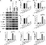 Collagen I Antibody in Western Blot (WB)