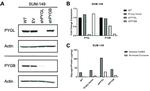 GPBB Antibody in Western Blot (WB)