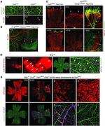 Claudin 5 Antibody in Immunohistochemistry (IHC)