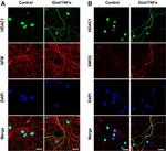 HDAC1 Antibody in Immunocytochemistry (ICC/IF)