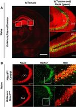 HDAC1 Antibody in Immunohistochemistry (IHC)