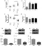 TPM1 Antibody in Western Blot (WB)