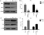 TPM2 Antibody in Western Blot (WB)