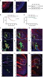 beta-3 Tubulin Antibody in Immunohistochemistry (IHC)