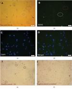 SOX2 Antibody in Immunocytochemistry (ICC/IF)