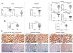 Prostasin Antibody in Immunohistochemistry (IHC)