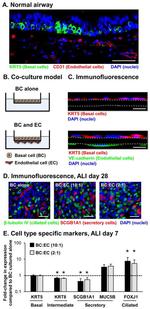 Cytokeratin 5 Antibody in Immunocytochemistry (ICC/IF)