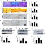 Collagen III Antibody