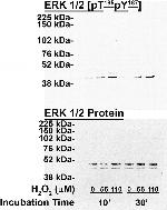 Phospho-ERK1/ERK2 (Thr185, Tyr187) Antibody in Western Blot (WB)