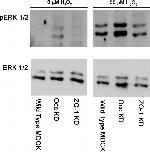 Phospho-ERK1/ERK2 (Thr185, Tyr187) Antibody in Western Blot (WB)