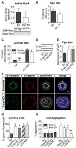 beta Catenin Antibody in Immunohistochemistry (IHC)