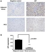 AIF Antibody in Immunohistochemistry (IHC)