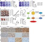 NEDD4 Antibody in Immunohistochemistry (IHC)