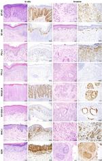 NY-ESO-1 Antibody in Immunohistochemistry (IHC)