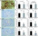 Aromatase Antibody in Immunohistochemistry (IHC)