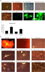 Doublecortin Antibody in Immunocytochemistry (ICC/IF)