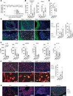 FOXP3 Antibody in Immunohistochemistry (IHC)