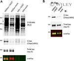 O-linked N-acetylglucosamine (O-GlcNAc) Antibody in Western Blot (WB)