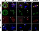 PLK1 Antibody in Immunocytochemistry (ICC/IF)